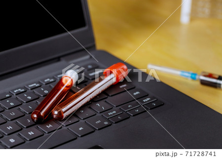 Medical in laboratory working on computer test blood tubes office of hospital Medical in laboratory working on computer test blood tubes office of hospital 71728741