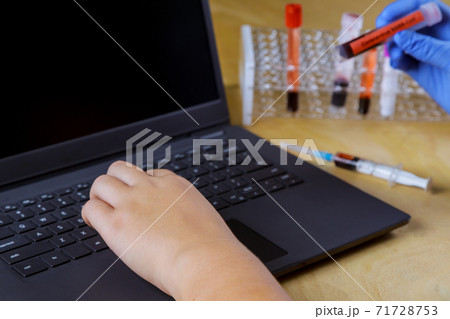 Doctor works with laptop medical equipment blood sample tube from rack with analysis in the lab test in the research laboratory Doctor works with laptop medical equipment blood sample tube from rack with analysis in the lab test in the research laboratory 71728753