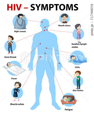 Symptoms of HIV infection infographic Symptoms of HIV infection infographic 71746659