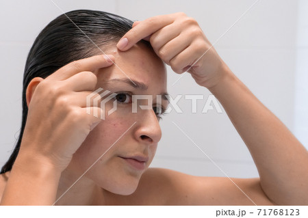 Close-up portrait of a girl squeezes out a pimple on her forehead. An awkward moment before a date Close-up portrait of a girl squeezes out a pimple on her forehead. An awkward moment before a date 71768123