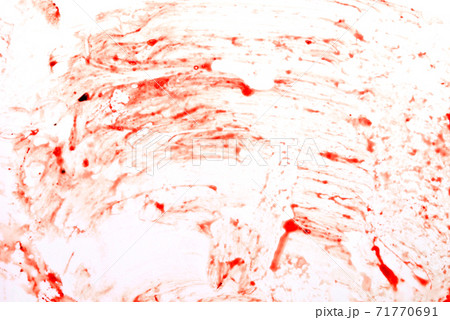 blood on white blood on white 71770691