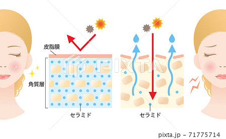 セラミド 乾燥肌 断面図 女性 ビフォアアフターのイラスト素材