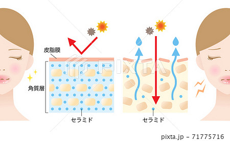 セラミド 乾燥肌 断面図 女性 ビフォアアフターのイラスト素材