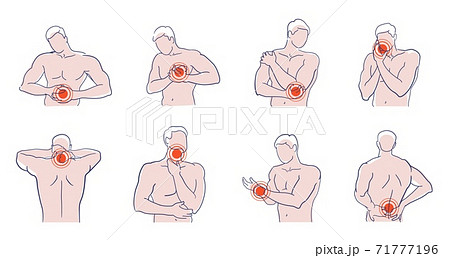 Man Suffering From Pain In Different Body Area Setのイラスト素材