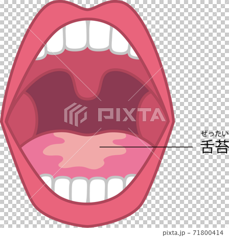 舌苔のイラスト 71800414