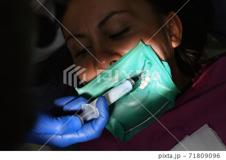 The dentist uses a blue gel to treat the patient's tooth. A woman at a dentist's appointment, a dentist uses a rubber dam and dental tools for treatment. The dentist uses a blue gel to treat the patient's tooth. A woman at a dentist's appointment, a dentist uses a rubber dam and dental tools for treatment. 71809096