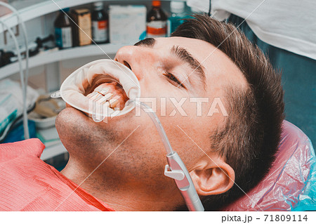 The procedure at the dentist,the dentist prepares the patient and tools to remove tartar, saliva ejector and retractor in the patient's mouth. The procedure at the dentist,the dentist prepares the patient and tools to remove tartar, saliva ejector and retractor in the patient's mouth. 71809114