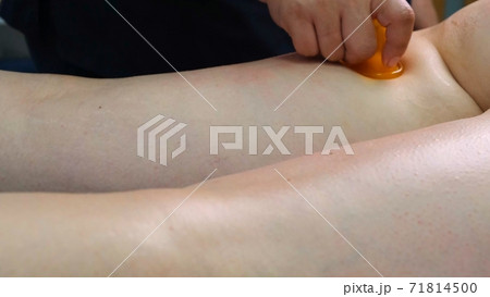 therapist makes an anti-cellulite massage. Masseur massaging thick female legs in the beauty salon therapist makes an anti-cellulite massage. Masseur massaging thick female legs in the beauty salon 71814500