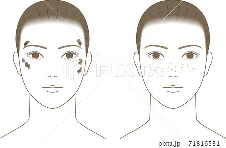 シミのある女性の顔 71816531