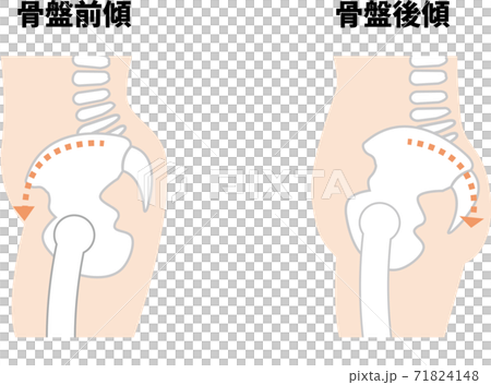 骨盤前傾・後傾 71824148