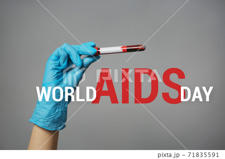 Nurse Holding Blood Sample World AIDS Day concept. Nurse Holding Blood Sample World AIDS Day concept. 71835591