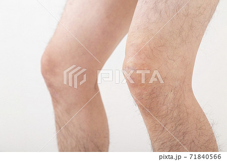 男性の膝 男性の膝 71840566