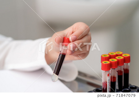 Test tube with blood in hand. Test tube with blood in hand. 71847079