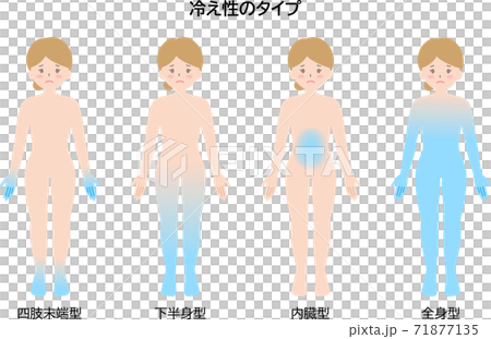 冷え性のタイプ 女性 冷え性のタイプ 女性 71877135