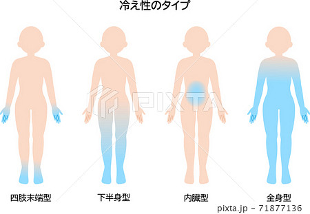 冷え性のタイプ 女性 冷え性のタイプ 女性 71877136