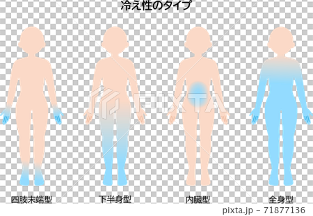 冷え性のタイプ 女性 冷え性のタイプ 女性 71877136