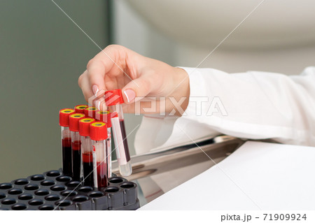 Blood sample tubes in hands. Blood sample tubes in hands. 71909924