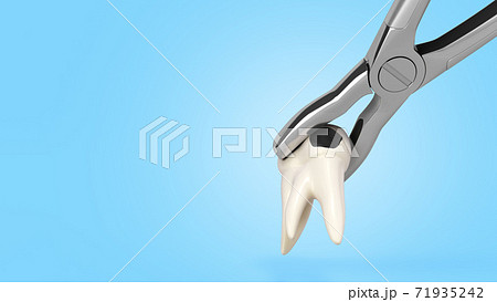 tooth clamped in medical extraction forceps dental services concept 3d render on blue gradient tooth clamped in medical extraction forceps dental services concept 3d render on blue gradient 71935242