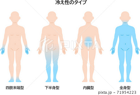 冷え性のタイプ　男性 71954223