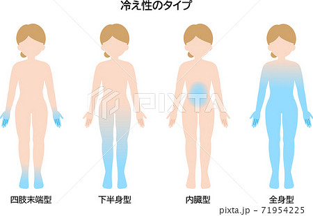 冷え性のタイプ　女性 71954225