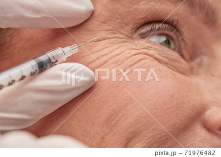 Cosmetologist hands in gloves holding syringe near female face Cosmetologist hands in gloves holding syringe near female face 71976482
