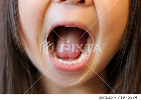 こどもの歯 71976574