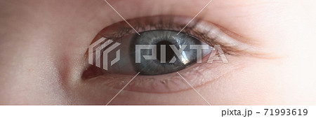 Young girl's eye with blue pupil closeup Young girl's eye with blue pupil closeup 71993619