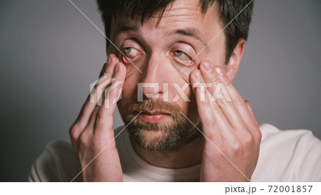 A young Caucasian male has a cold and has a runny nose. The male at home in bed sneezes due to the seasonal virus. The guy suffers from allergies and suffers. Human flu. Can't believe I'm sick again A young Caucasian male has a cold and has a runny nose. The male at home in bed sneezes due to the seasonal virus. The guy suffers from allergies and suffers. Human flu. Can't believe I'm sick again 72001857
