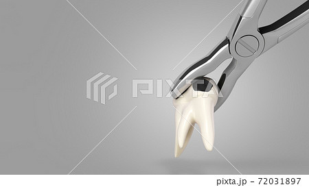 tooth clamped in medical extraction forceps dental services concept 3d render on grey gradient tooth clamped in medical extraction forceps dental services concept 3d render on grey gradient 72031897