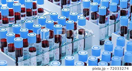 検査 実験室 ウイルス 72033274