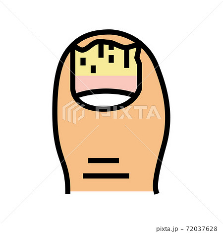 onychomycosis nail disease color icon vector illustration 72037628