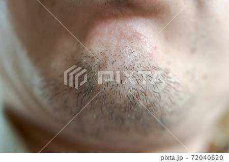あごひげ あごひげ 72040620