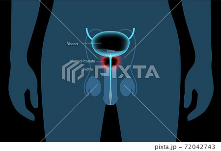 Normal bones concept 72042743