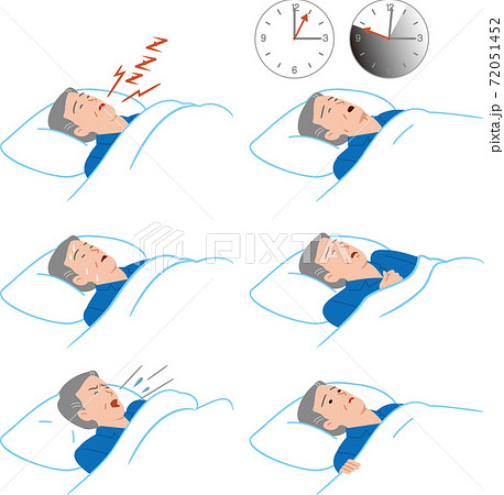 睡眠時無呼吸症候群のシニアの男性 72051452