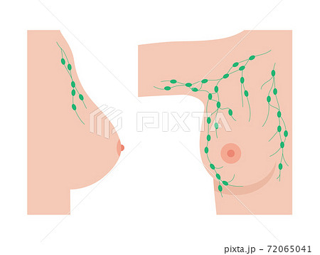 Breast disease concept Breast disease concept 72065041