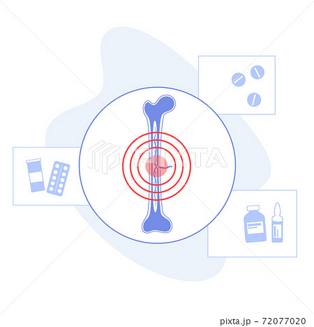 Bones template concept 72077020