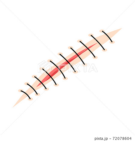 Cut suture scar vector icon. First aid injury stitch skin concept wound Cut suture scar vector icon. First aid injury stitch skin concept wound 72078604