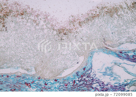 Penicillium, ascomycetous fungi are of major importance in the natural environment as well as food and drug production.  72099085