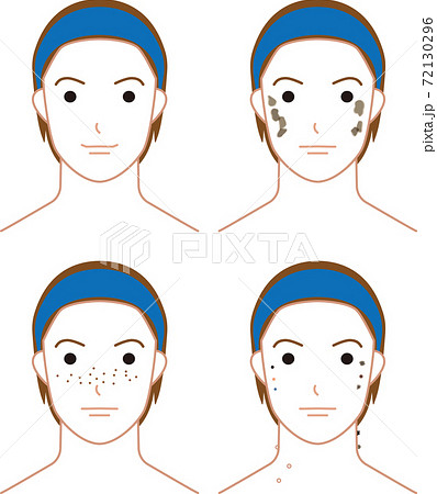 しみ そばかす ほくろのある男性のイラスト素材
