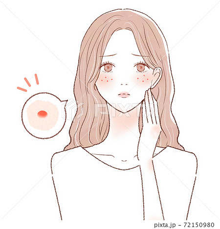 ニキビを気にする女性 72150980