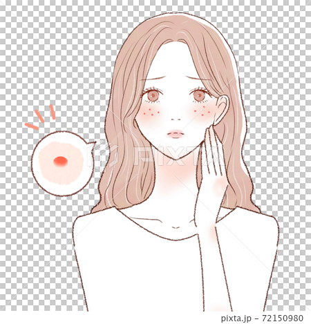 ニキビを気にする女性 72150980