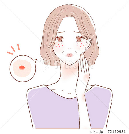 ニキビを気にする中年女性 72150981