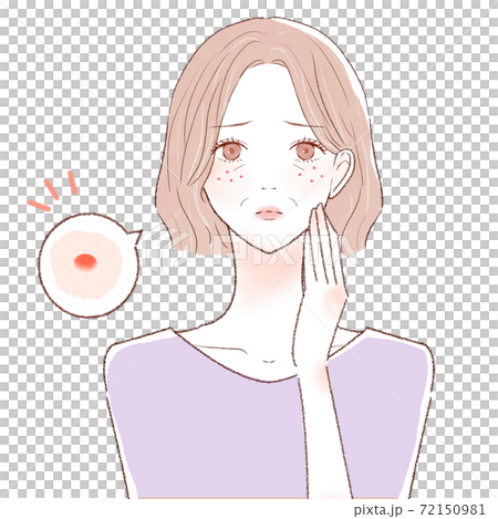 ニキビを気にする中年女性 72150981