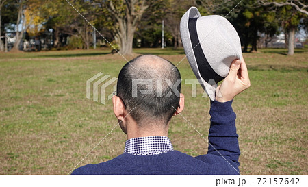 公園で薄毛・坊主の男性が帽子をとって挨拶 公園で薄毛・坊主の男性が帽子をとって挨拶 72157642