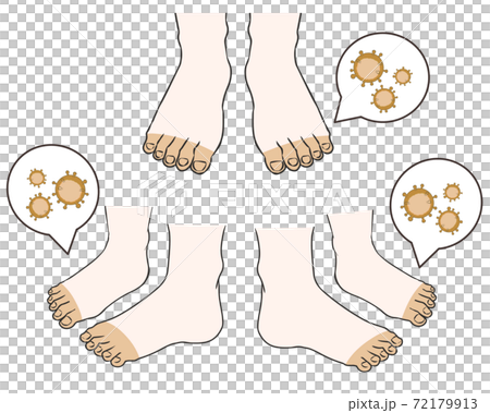 Foot white bacteria Foot white bacteria 72179913
