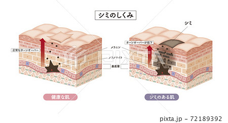 Cross section of the skin 2 72189392