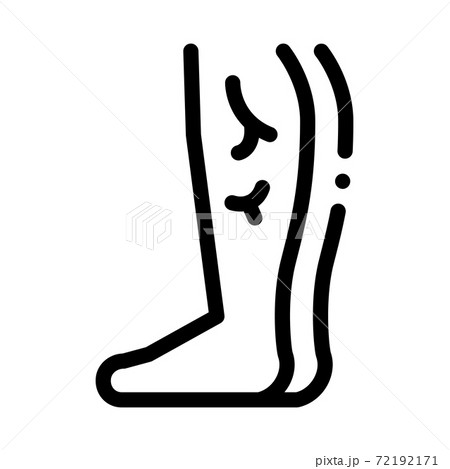 leg with varicose veins black icon vector illustration 72192171