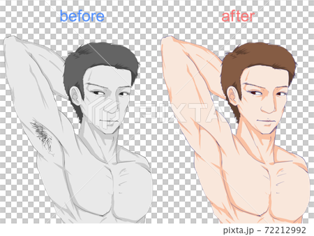 メンズ_脇の処理_ビフォーアフター 72212992