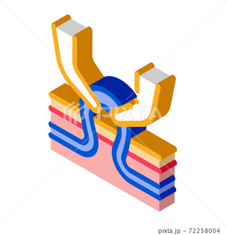 veins medical treatment isometric icon vector illustration 72258004