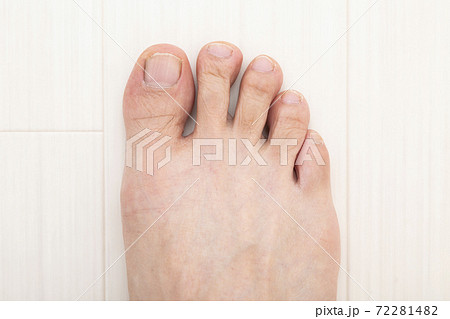足指 72281482
